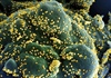 Phát hiện biến thể mới của virus SARS-CoV-2 chứa 46 đột biến